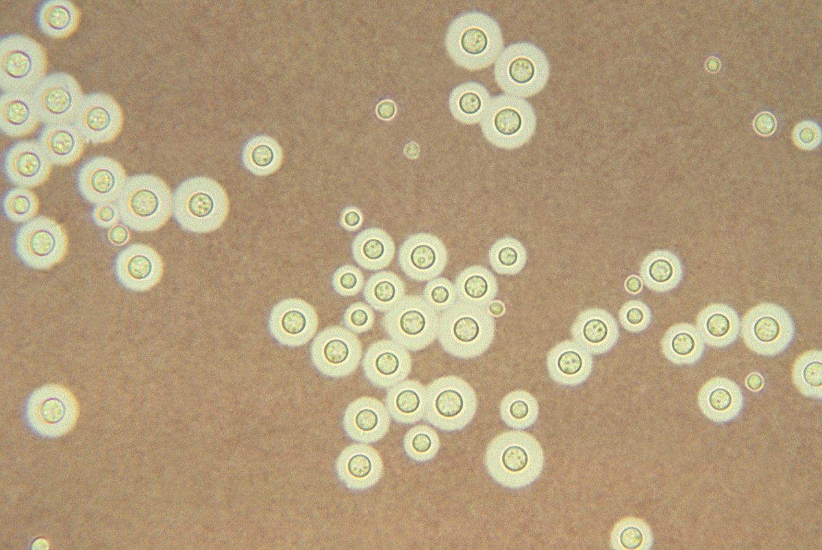 Cruptococcus neoformans козу карыны  микроскоптон караганда